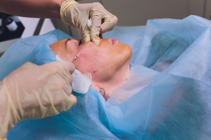 Pequenas cirurgias dermatológicas