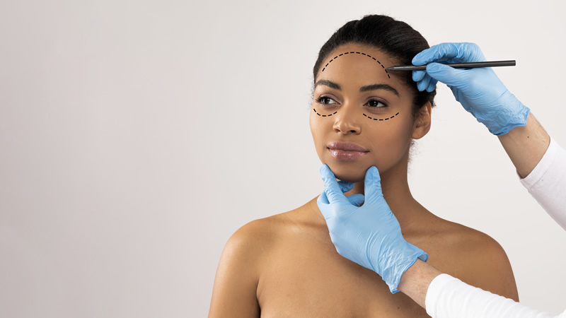 Fios de PDO e de sustentação