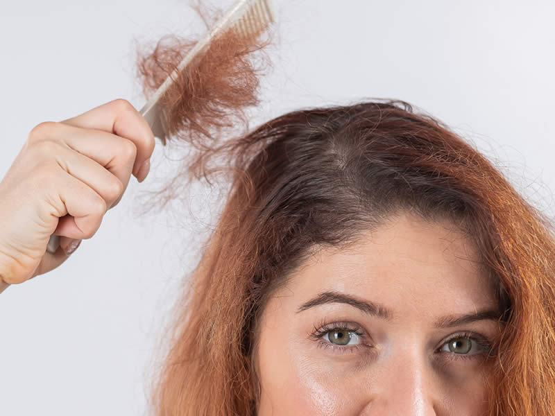 Tratamento de cabelos (alopecias, dermatite seborreica e caspa)